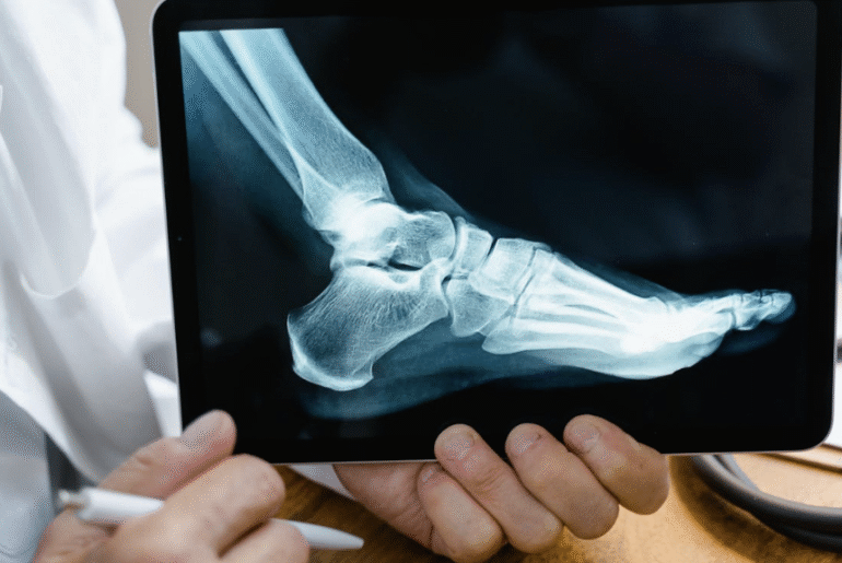 How to Get the Best Personal Injury Compensation - Verified by FangWallet